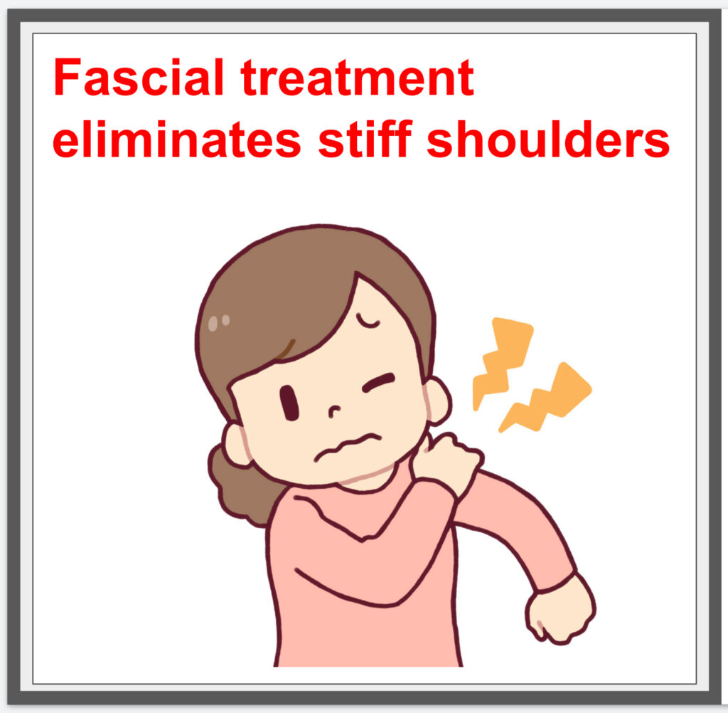 Fascial treatment eliminates stiff shoulders. ^^