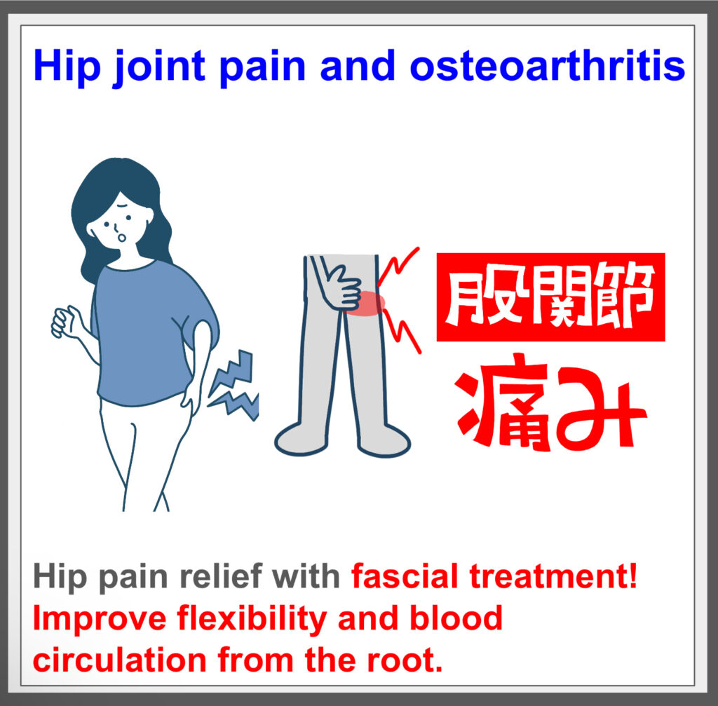 Relieve osteoarthritis with fascial treatment.