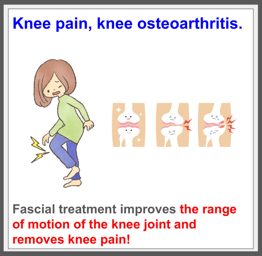 Fascial treatment treats knee pain from the root! ^^