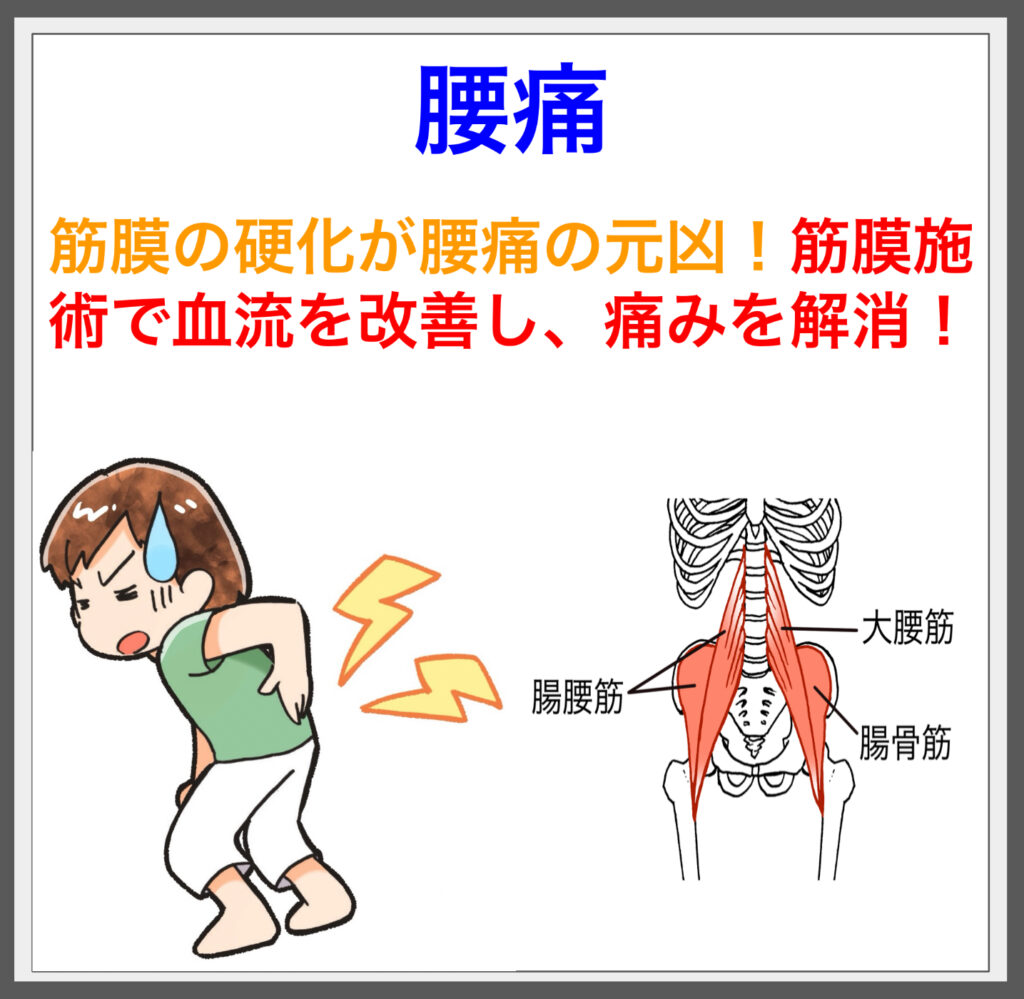 腰痛は筋膜の緊張から！筋膜施術で改善！^^