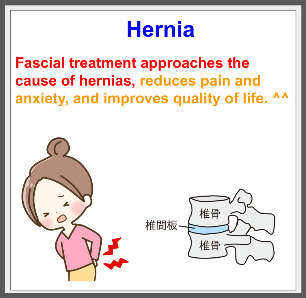 Fascial treatment eliminates the cause of hernias! ^^