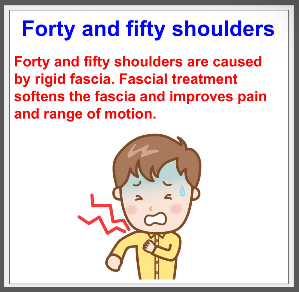 Get rid of the pain of 40/50 shoulder with fascial treatment!^^