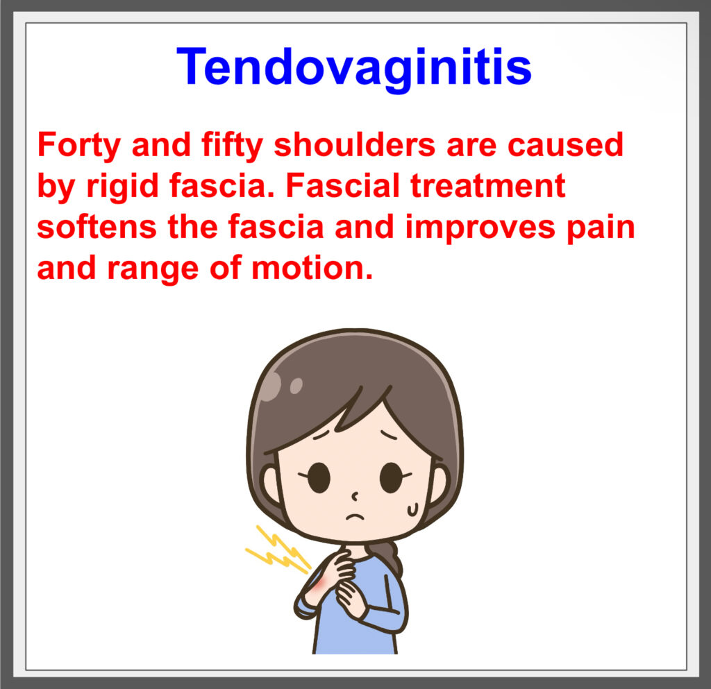 Tendonitis problems, clear up with fascial treatment! ^^