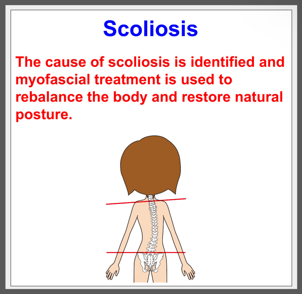 Treat scoliosis and improve posture!