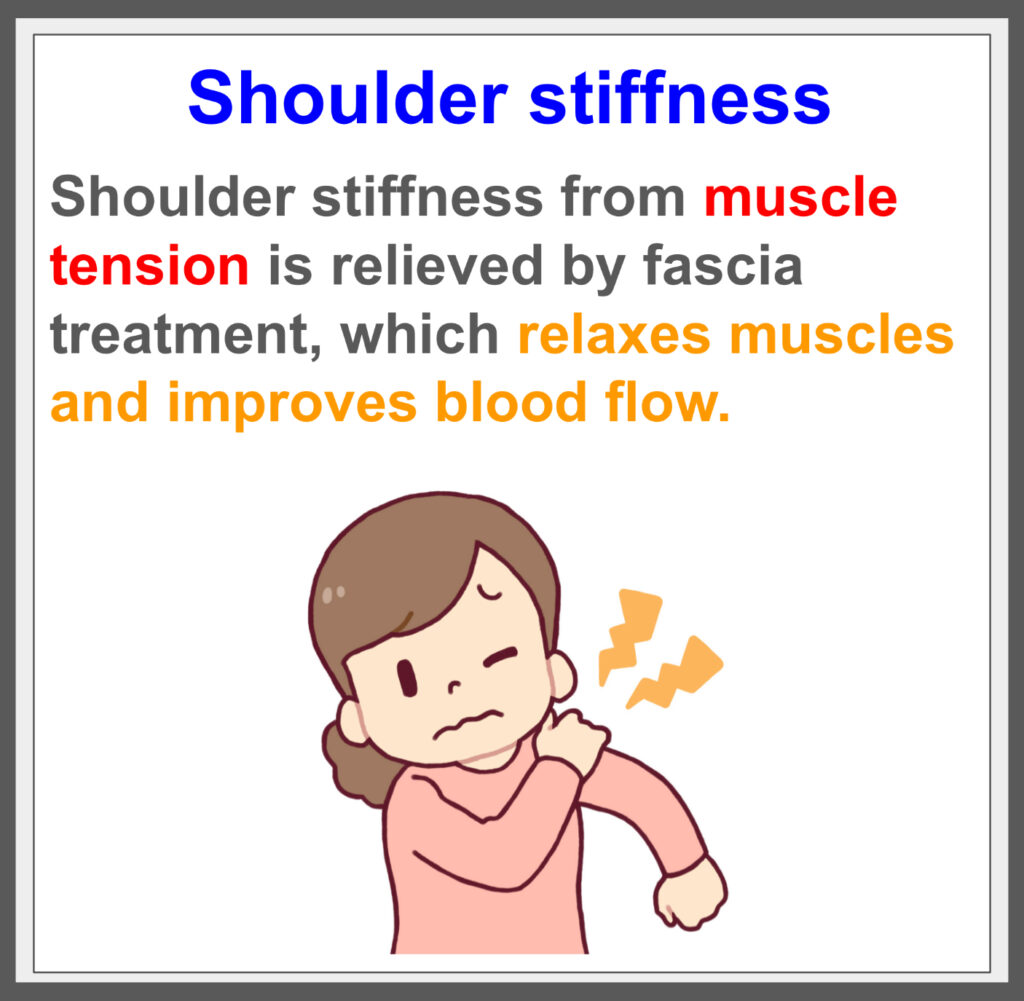 Relieve shoulder stiffness with fascia treatment!