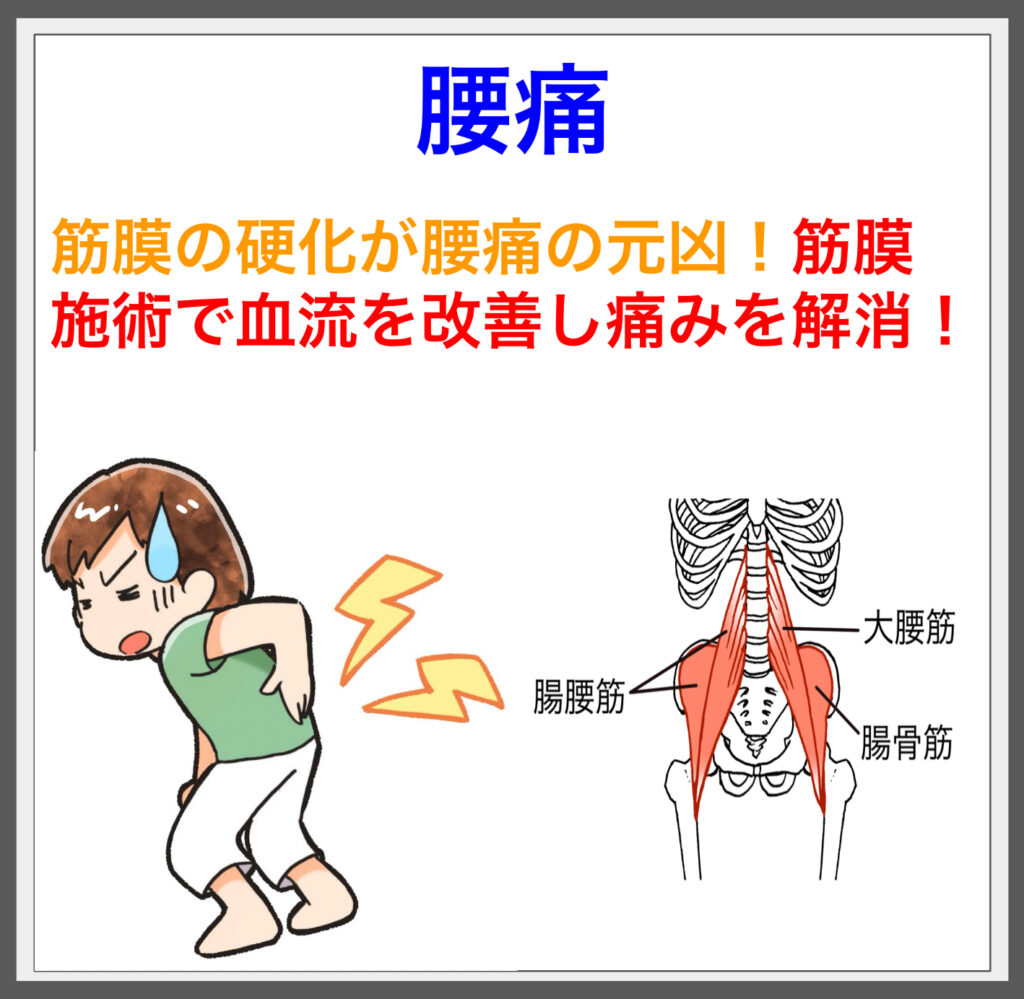 腰痛は筋膜の緊張から！筋膜施術で改善!!