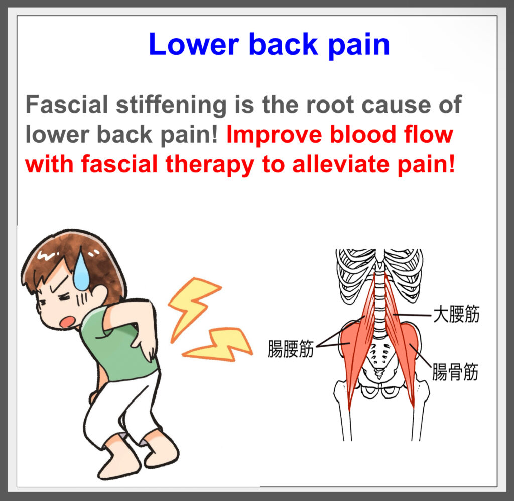 Fascial treatment treats lower back pain from the root!