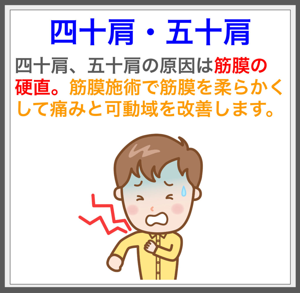 筋膜施術で四十肩/五十肩の辛さを取り除こう！^^