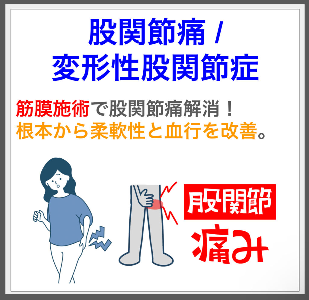 筋膜施術で股関節痛解消！ 根本から柔軟性と血行を改善。