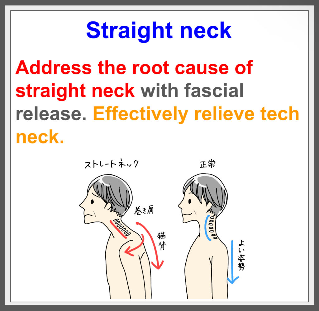 Effective for  Straight Neck with fascial treatment