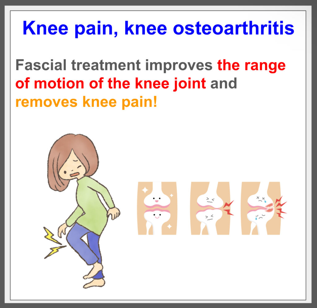 Fascial treatment treats knee pain from the root!