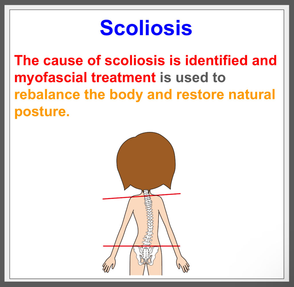 Treat scoliosis and improve posture!