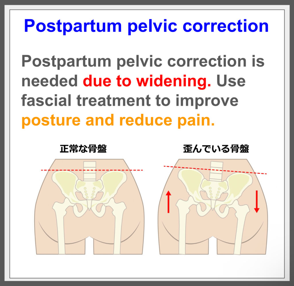 Correct Pelvic Misalignment: Relieve Pain!