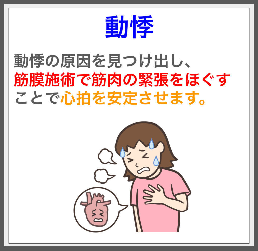 動悸の原因を筋膜施術で解消、リラックスを実感！