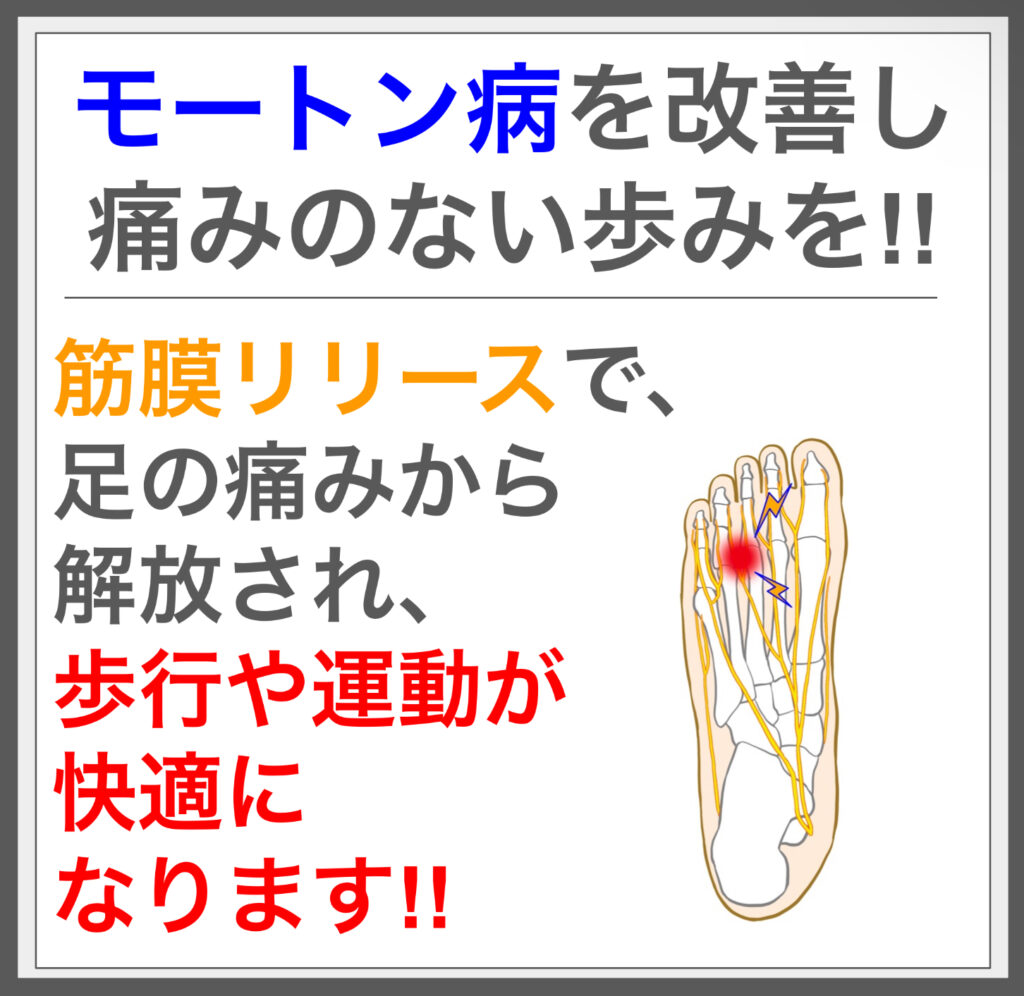 足裏の痛みを解消！筋膜施術でモートン病に終止符