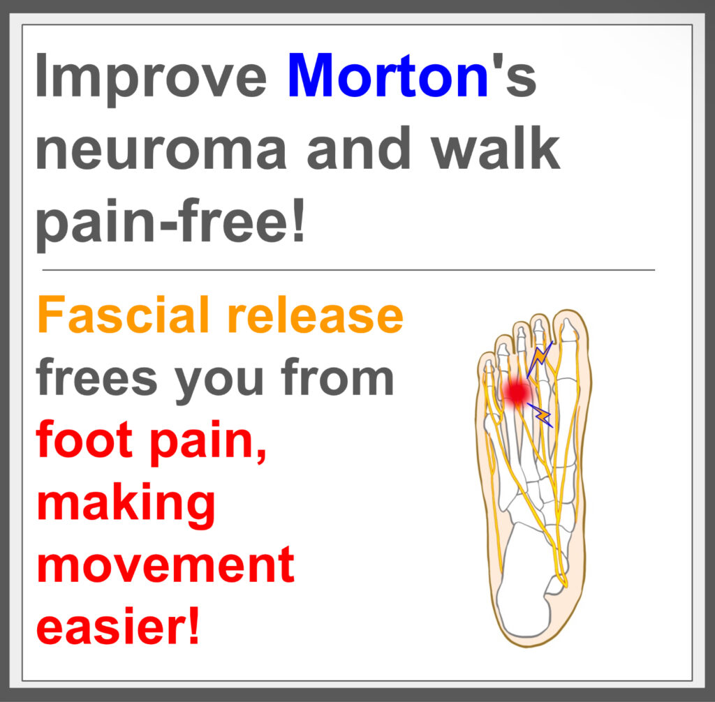 End Morton's disease with fascial treatment!