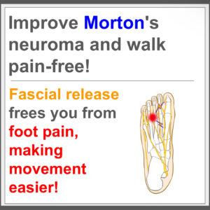 End Morton’s disease with fascial treatment!