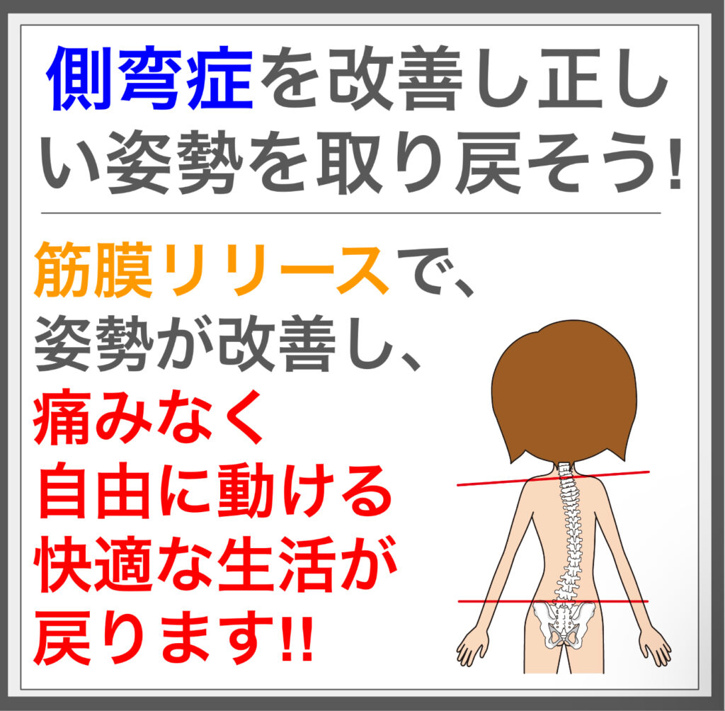 側湾症の要因を解消、筋膜施術で姿勢を整える