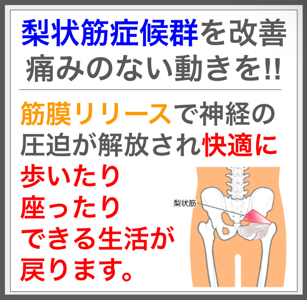 梨状筋症候群は神経圧迫で痛み。筋膜施術で解消。