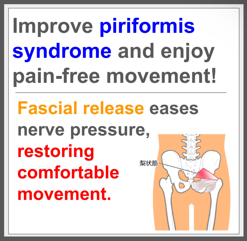 Piriformis syndrome causes pain; fascia helps.