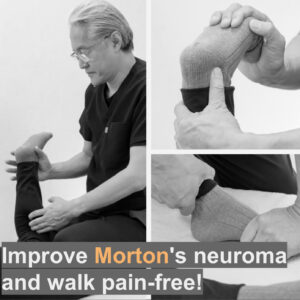 End Morton’s disease with fascial treatment!