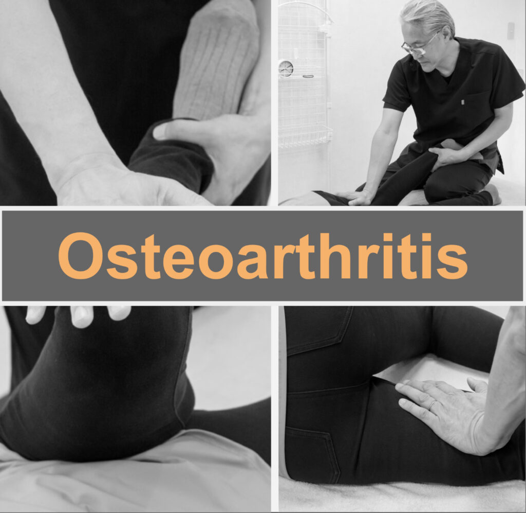 Relieve osteoarthritis with fascial treatment.