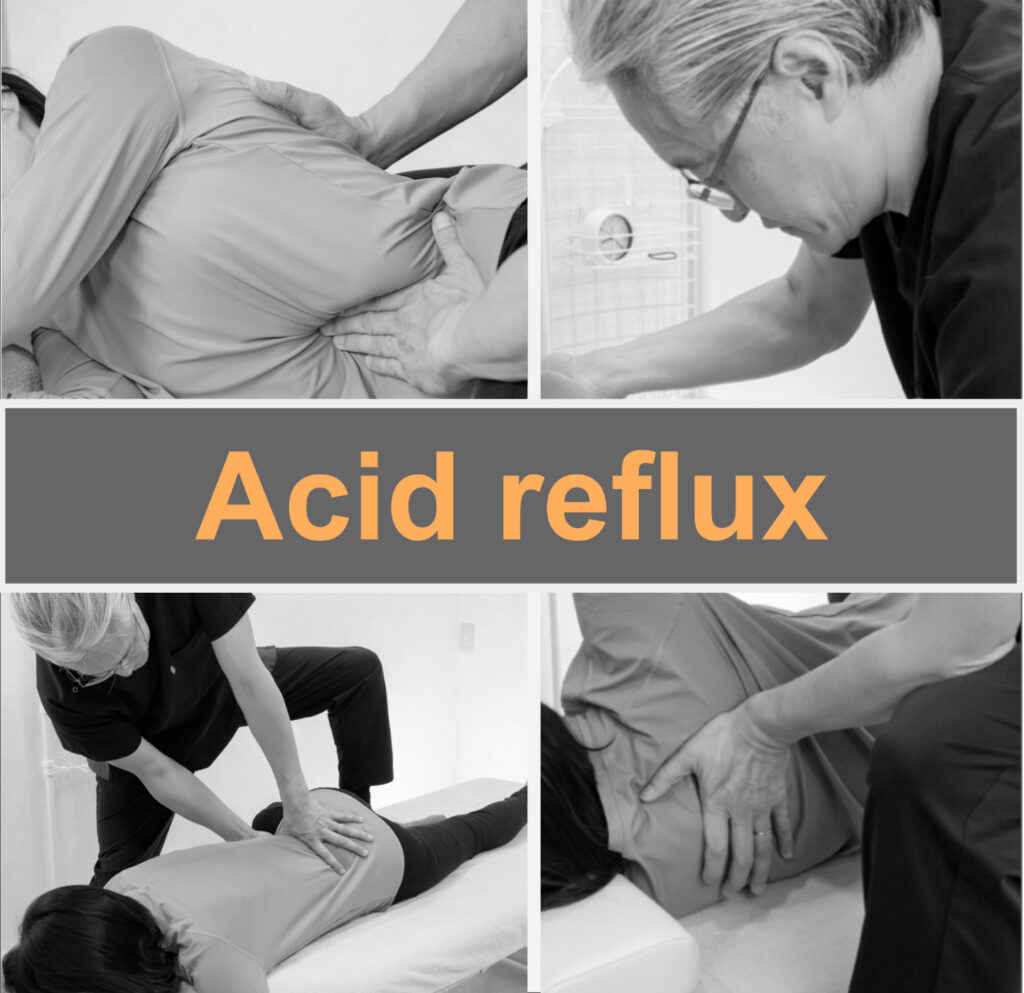 Fascial treatment improved acid reflux.