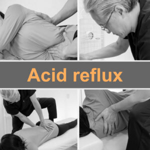 Fascial treatment improved acid reflux.