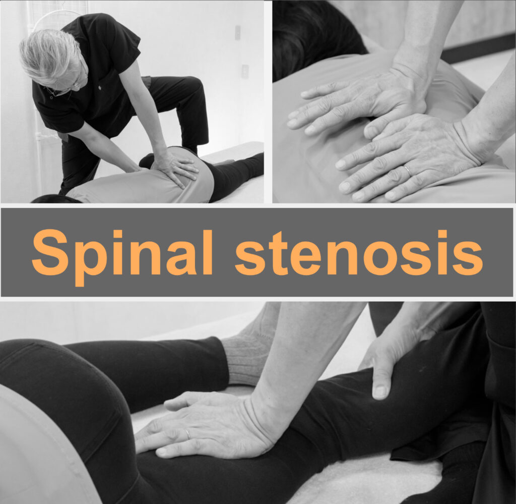 Identifying spinal stenosis causes, curing it.