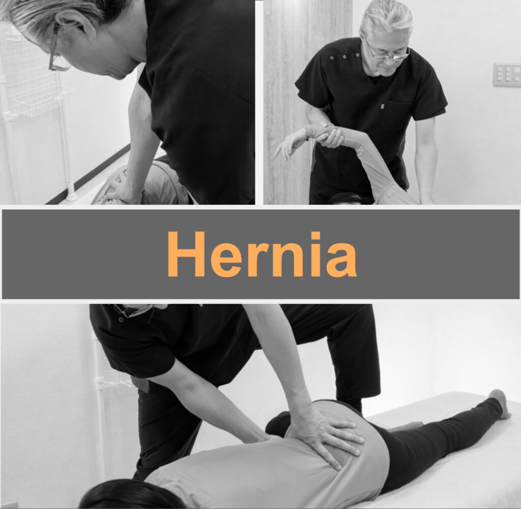 Fascial treatment eliminates the cause of hernias!