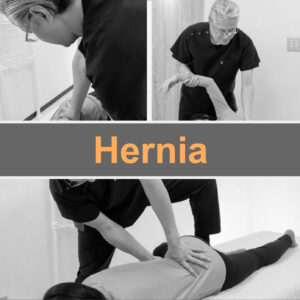 Fascial treatment eliminates the cause of hernias!