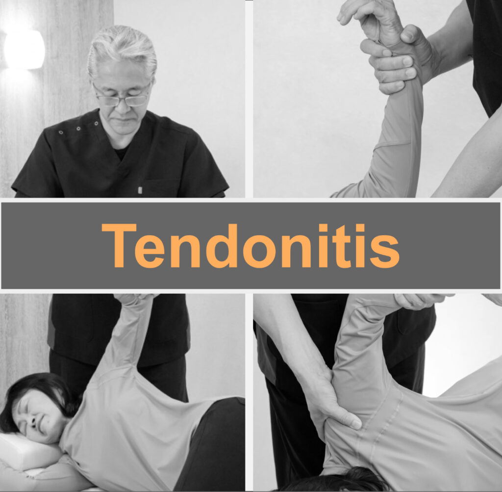 Tendovaginitis resolved with fascial treatment.