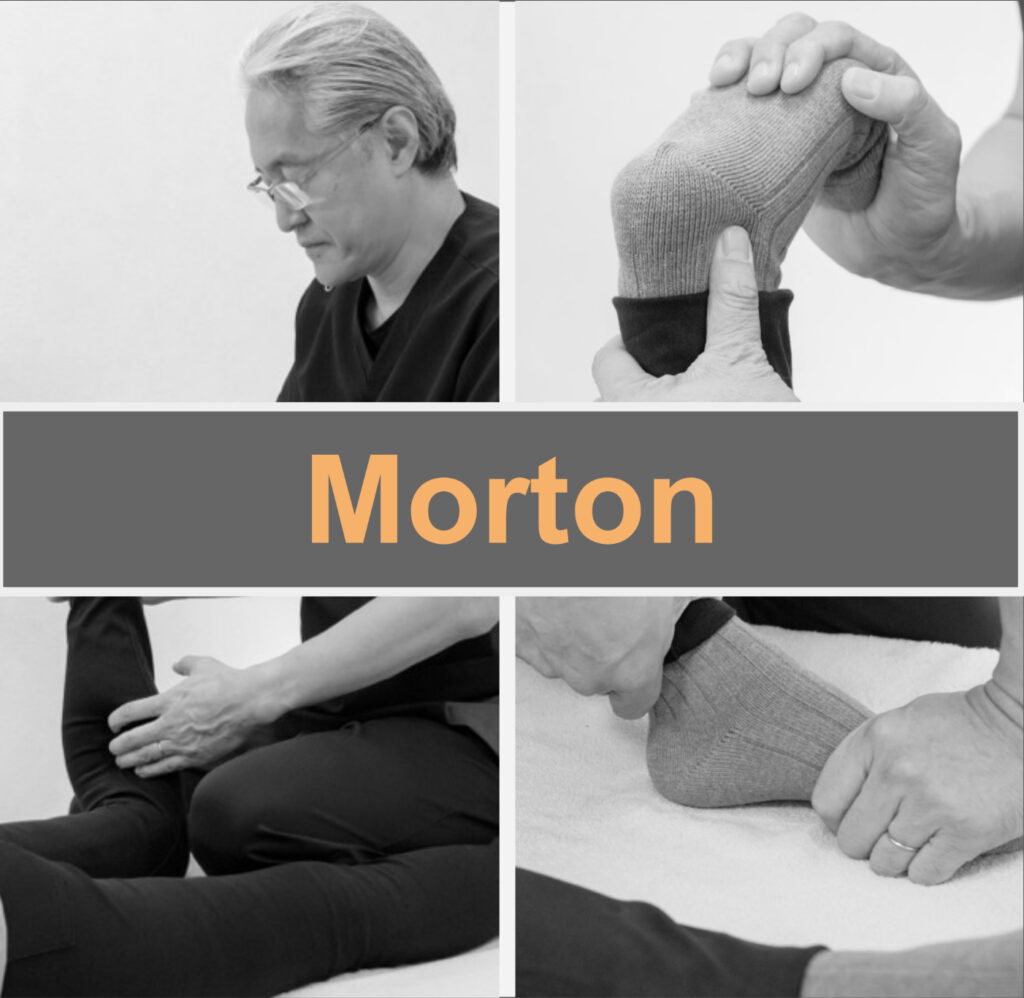 End Morton’s disease with fascial treatment!