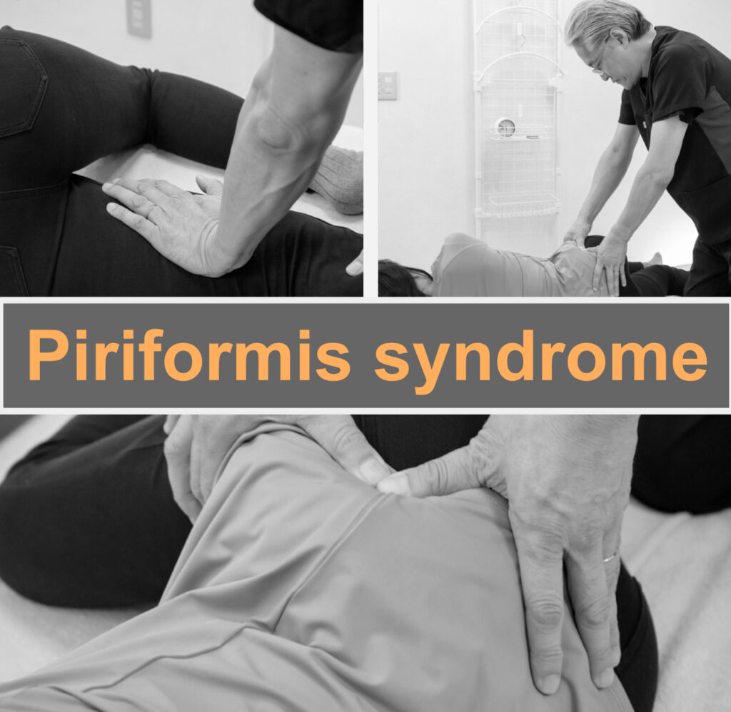 Piriformis syndrome causes pain; fascia helps.